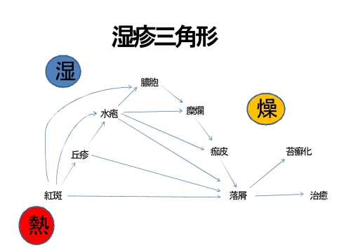 湿疹三角形